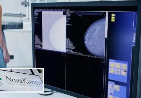 mamografias falsas practicadas centro medico concepcion